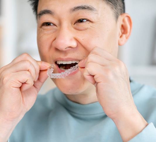 a man putting clear aligners in his mouth