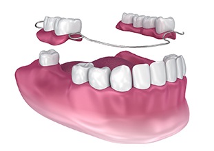 Senior man with glasses smiling with dentures in Raleigh, NC