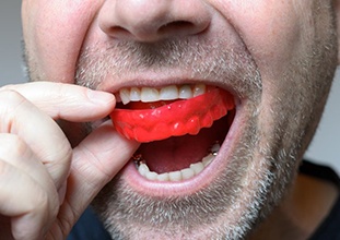 man putting a red mouthguard into his mouth 