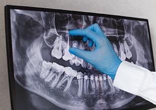 dentist looking at X-ray 