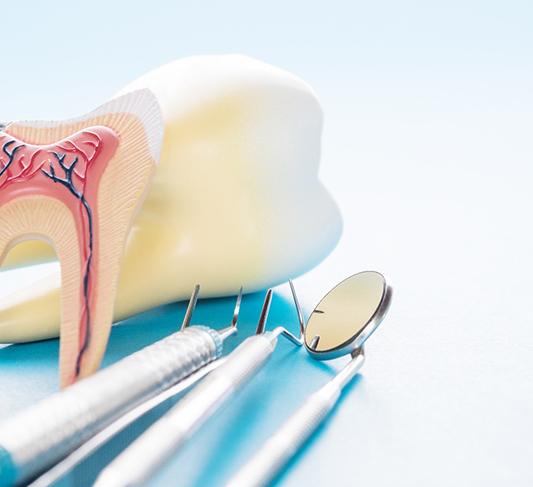 Model of tooth with decay and inner nerves