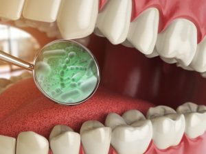 dental mirror in mouth revealing bacteria