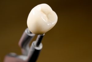 Newly crafted dental crowns in North Raleigh