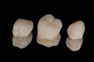 a close-up of a few different dental crowns